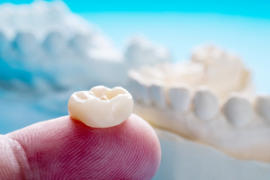 Close up of a dental crown sitting on top of a fingertip